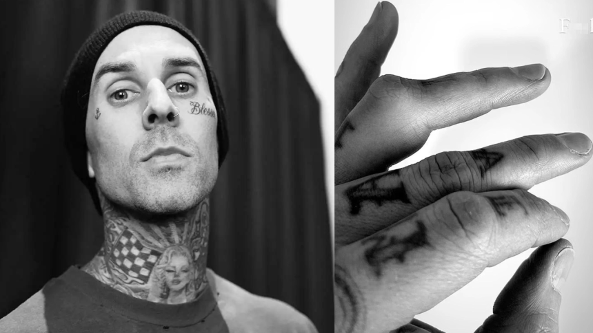 Travis Barker - dedo dislocado
